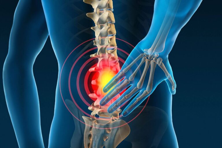 low back pain
