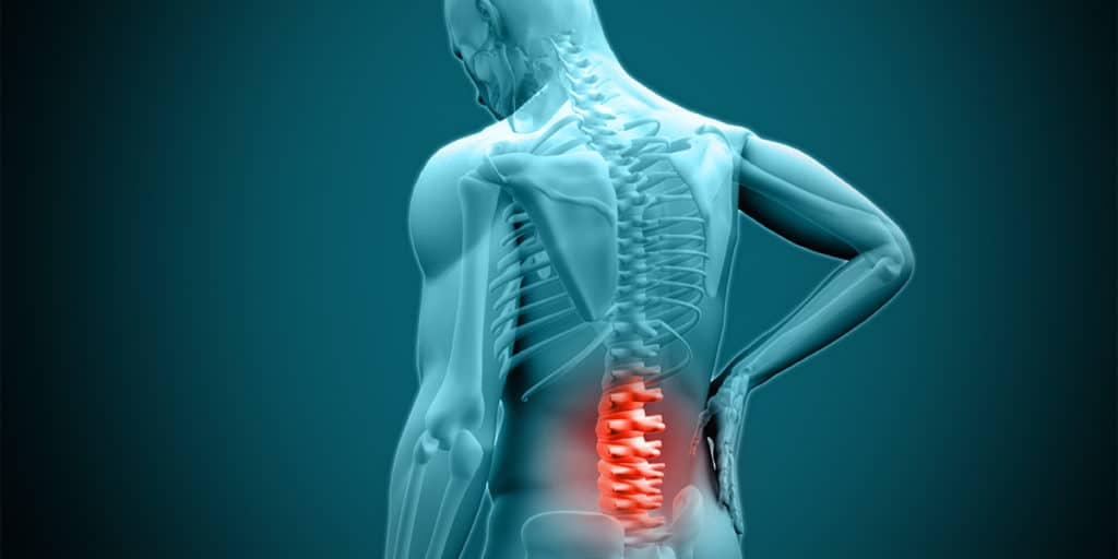 Is It Time To See A Physical Therapist For That Herniated Disc of Yours?