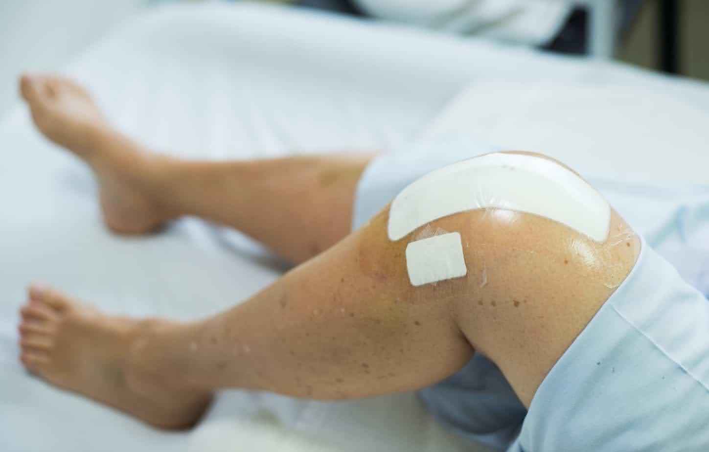 knee replacement recovery process