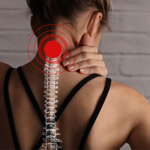 Neck Pain Anatomy